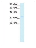 Anti-NPM1 (AB2) antibody produced in rabbit IgG fraction of antiserum