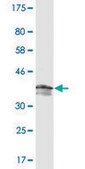 Monoclonal Anti-PDE5A antibody produced in mouse clone 1F11, purified immunoglobulin, buffered aqueous solution