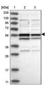 Anti-TRMT13 antibody produced in rabbit Prestige Antibodies&#174; Powered by Atlas Antibodies, affinity isolated antibody, buffered aqueous glycerol solution