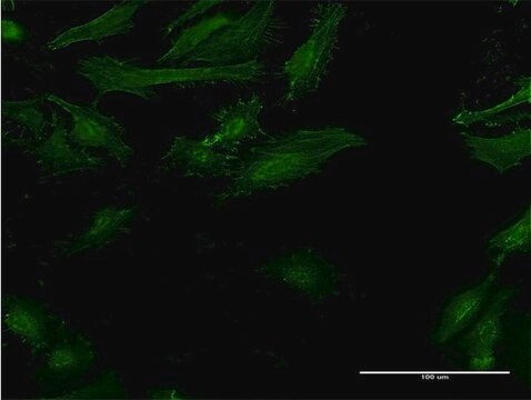 Monoclonal Anti-IFNGR2 antibody produced in mouse clone 2D9, purified immunoglobulin, buffered aqueous solution