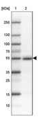 Anti-FAM149B1 antibody produced in rabbit Prestige Antibodies® Powered by Atlas Antibodies, affinity isolated antibody, buffered aqueous glycerol solution