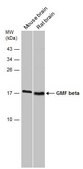 Anti-GMFB antibody produced in rabbit affinity isolated antibody, buffered aqueous solution