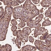 Anti-BABAM1 antibody produced in rabbit Prestige Antibodies&#174; Powered by Atlas Antibodies, affinity isolated antibody, buffered aqueous glycerol solution