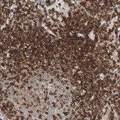 Monoclonal Anti-CD5 antibody produced in mouse Prestige Antibodies® Powered by Atlas Antibodies, clone CL12334, purified immunoglobulin, buffered aqueous glycerol solution