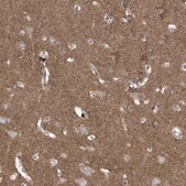 Anti-P2RX7 antibody produced in rabbit Prestige Antibodies&#174; Powered by Atlas Antibodies, affinity isolated antibody, buffered aqueous glycerol solution