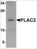 Anti-PLAC2 antibody produced in rabbit affinity isolated antibody, buffered aqueous solution