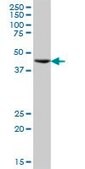 Anti-ST13 antibody produced in mouse IgG fraction of antiserum, buffered aqueous solution