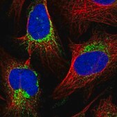 Anti-COX20 antibody produced in rabbit Prestige Antibodies® Powered by Atlas Antibodies, affinity isolated antibody, buffered aqueous glycerol solution