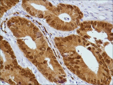 Anti-CDX2 antibody, Rabbit monoclonal clone SP54, recombinant, expressed in proprietary host, affinity isolated antibody