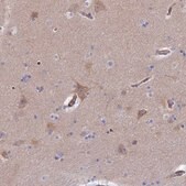 Anti-CLVS2 antibody produced in rabbit Prestige Antibodies® Powered by Atlas Antibodies, affinity isolated antibody, buffered aqueous glycerol solution
