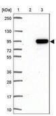 Anti-WHSC1 antibody produced in rabbit Prestige Antibodies® Powered by Atlas Antibodies, affinity isolated antibody, buffered aqueous glycerol solution