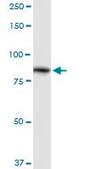Anti-ALDH16A1 antibody produced in rabbit purified immunoglobulin, buffered aqueous solution