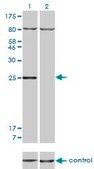 Monoclonal Anti-HOXB7 antibody produced in mouse clone 5B2, purified immunoglobulin, buffered aqueous solution