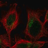 Anti-TMEM104 antibody produced in rabbit Prestige Antibodies&#174; Powered by Atlas Antibodies, affinity isolated antibody, buffered aqueous glycerol solution