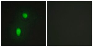 Anti-HNRNP C1 antibody produced in rabbit affinity isolated antibody