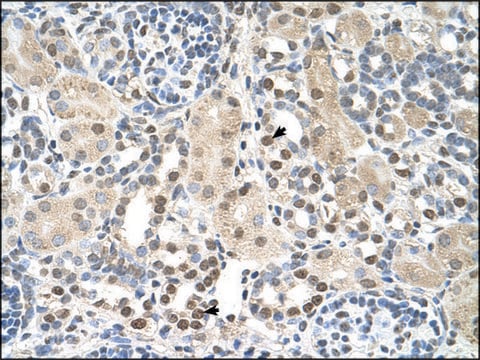 Anti-PSAT1 antibody produced in rabbit affinity isolated antibody