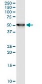 Monoclonal Anti-ENO1 antibody produced in mouse clone 3C8, purified immunoglobulin, buffered aqueous solution
