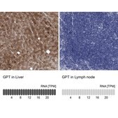 Anti-GPT antibody produced in rabbit Prestige Antibodies&#174; Powered by Atlas Antibodies, affinity isolated antibody, buffered aqueous glycerol solution, ab2