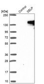 Anti-SELP antibody produced in rabbit Ab2, Prestige Antibodies&#174; Powered by Atlas Antibodies, affinity isolated antibody, buffered aqueous glycerol solution