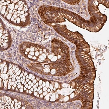 Anti-CEP95 antibody produced in rabbit Prestige Antibodies&#174; Powered by Atlas Antibodies, affinity isolated antibody, buffered aqueous glycerol solution