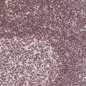 Anti-RARG antibody produced in rabbit Prestige Antibodies® Powered by Atlas Antibodies, affinity isolated antibody, buffered aqueous glycerol solution