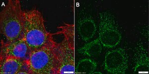 Anti-C1QBP Antibody, clone 3D2 ZooMAb&#174; Rabbit Monoclonal recombinant, expressed in HEK 293 cells
