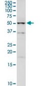 Anti-UGP2 antibody produced in rabbit purified immunoglobulin, buffered aqueous solution