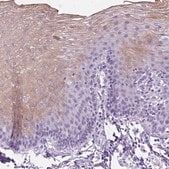 Anti-UPP1 antibody produced in rabbit Prestige Antibodies&#174; Powered by Atlas Antibodies, affinity isolated antibody, buffered aqueous glycerol solution