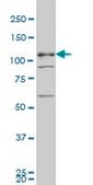 Monoclonal Anti-TBC1D8 antibody produced in mouse clone 1A12, purified immunoglobulin, buffered aqueous solution