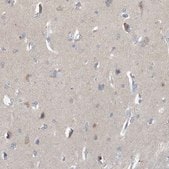 Anti-VTA1 antibody produced in rabbit Prestige Antibodies® Powered by Atlas Antibodies, affinity isolated antibody, buffered aqueous glycerol solution