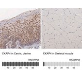 Anti-CKAP4 antibody produced in rabbit Ab2, Prestige Antibodies&#174; Powered by Atlas Antibodies, affinity isolated antibody, buffered aqueous glycerol solution