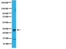 Anti-PP6C Antibody from rabbit