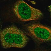 Anti-CACTIN antibody produced in rabbit Prestige Antibodies® Powered by Atlas Antibodies, affinity isolated antibody, buffered aqueous glycerol solution