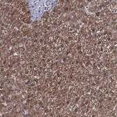 Anti-GRHPR antibody produced in rabbit Prestige Antibodies&#174; Powered by Atlas Antibodies, affinity isolated antibody, buffered aqueous glycerol solution