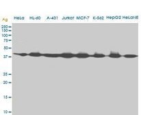 ANTI-AHCY antibody produced in mouse clone M2, purified immunoglobulin, buffered aqueous solution