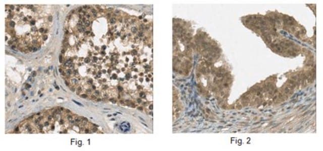 Anti-FSH, &#946;-subunit Antibody serum, from goat