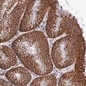Anti-RAB39B antibody produced in rabbit Prestige Antibodies&#174; Powered by Atlas Antibodies, affinity isolated antibody, buffered aqueous glycerol solution