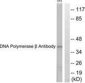 Anti-DNA Polymerase β antibody produced in rabbit affinity isolated antibody
