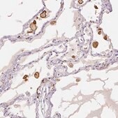 Anti-MRC1 antibody produced in rabbit Prestige Antibodies® Powered by Atlas Antibodies, affinity isolated antibody, buffered aqueous glycerol solution