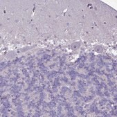 Anti-SLC15A3 antibody produced in rabbit Prestige Antibodies&#174; Powered by Atlas Antibodies, affinity isolated antibody, buffered aqueous glycerol solution
