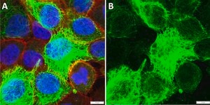 Anti-Cytokeratin-15 Antibody, clone 1O13 ZooMAb&#174; Rabbit Monoclonal recombinant, expressed in HEK 293 cells