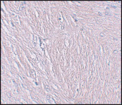 Anti-SYNPO antibody produced in rabbit affinity isolated antibody, buffered aqueous solution