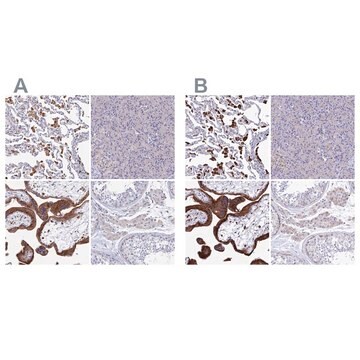 Anti-SPNS1 antibody produced in rabbit Prestige Antibodies® Powered by Atlas Antibodies, affinity isolated antibody, buffered aqueous glycerol solution