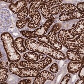 Anti-GLYAT antibody produced in rabbit Prestige Antibodies&#174; Powered by Atlas Antibodies, affinity isolated antibody