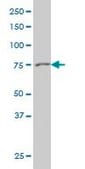 Monoclonal Anti-GSN antibody produced in mouse clone 3G5, purified immunoglobulin, buffered aqueous solution