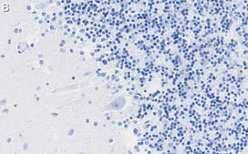 Anti-DNA Polymerase beta Antibody, clone 3F21 ZooMAb&#174; Rabbit Monoclonal recombinant, expressed in HEK 293 cells