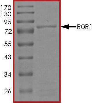 ROR1, Active PRECISIO&#174; Kinase, recombinant