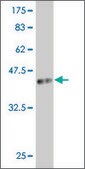 Monoclonal Anti-ARX antibody produced in mouse clone 3A4, purified immunoglobulin, buffered aqueous solution