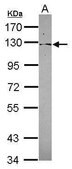 Anti-PSD4 antibody produced in rabbit affinity isolated antibody, buffered aqueous solution