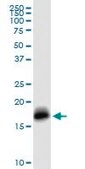 Anti-IFITM3 antibody produced in rabbit purified immunoglobulin, buffered aqueous solution